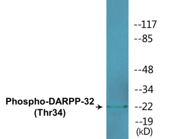 DARPP-32 (phospho Thr34) Cell Based ELISA Kit