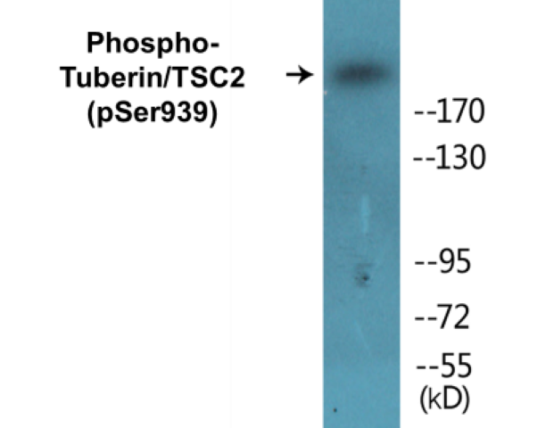 Tuberin (phospho Ser939) Cell Based ELISA Kit