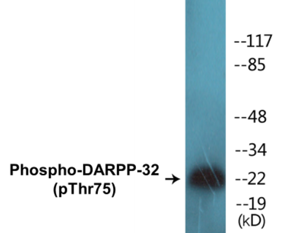 DARPP-32 (phospho Thr75) Cell Based ELISA Kit