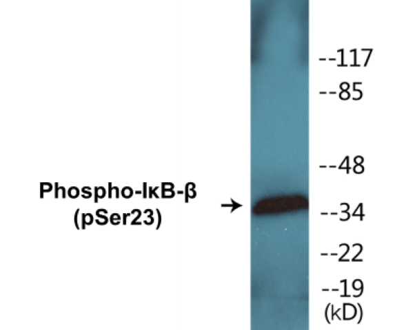 IkB beta (phospho Ser23) Cell Based ELISA Kit