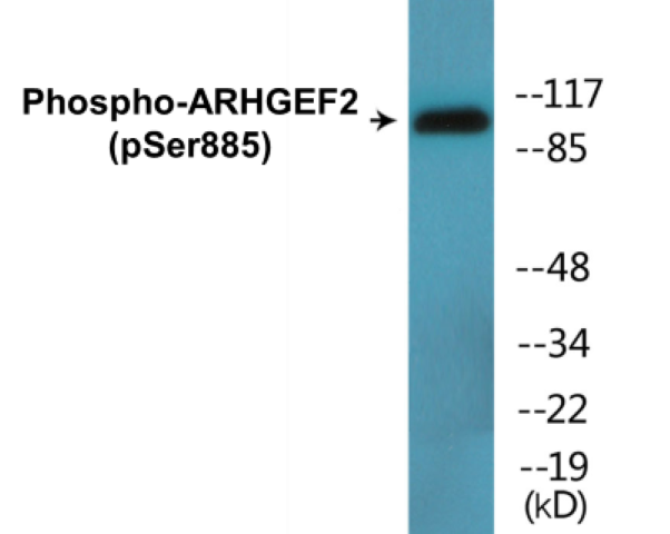 ARHGEF2 (phospho Ser885) Cell Based ELISA Kit
