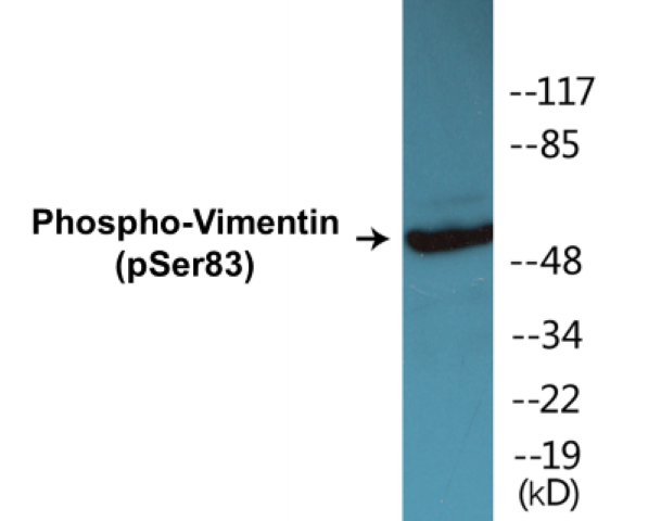 Vimentin (phospho Ser83) Cell Based ELISA Kit