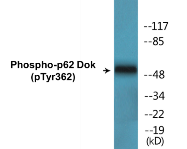 p62 Dok (phospho Tyr362) Cell Based ELISA Kit