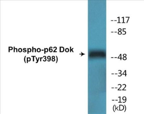 p62 Dok (phospho Tyr398) Cell Based ELISA Kit