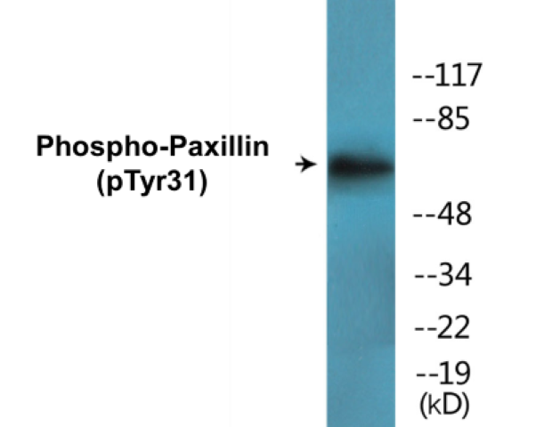 Paxillin (phospho Tyr31) Cell Based ELISA Kit