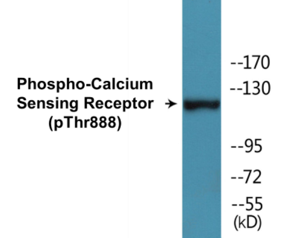 Calcium Sensing Receptor (phospho Thr888) Cell Based ELISA Kit