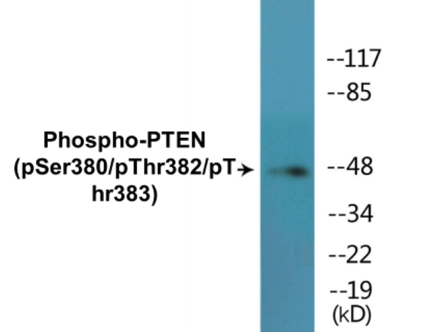 PTEN (phospho Ser380 + Thr382 + Thr383) Cell Based ELISA Kit