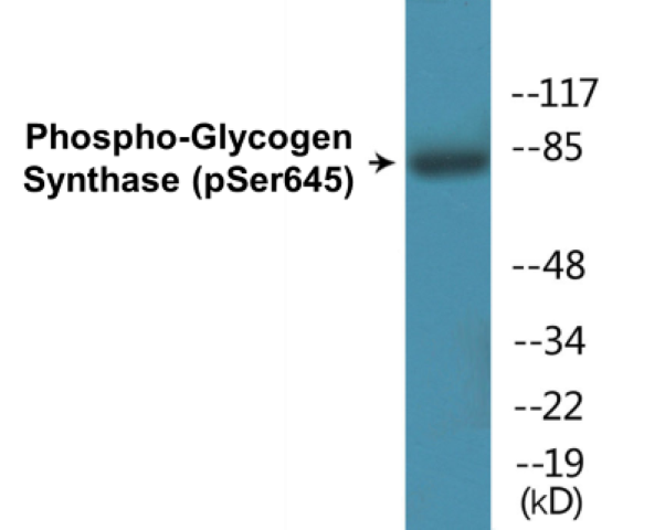 Glycogen Synthase (phospho Ser645) Cell Based ELISA Kit