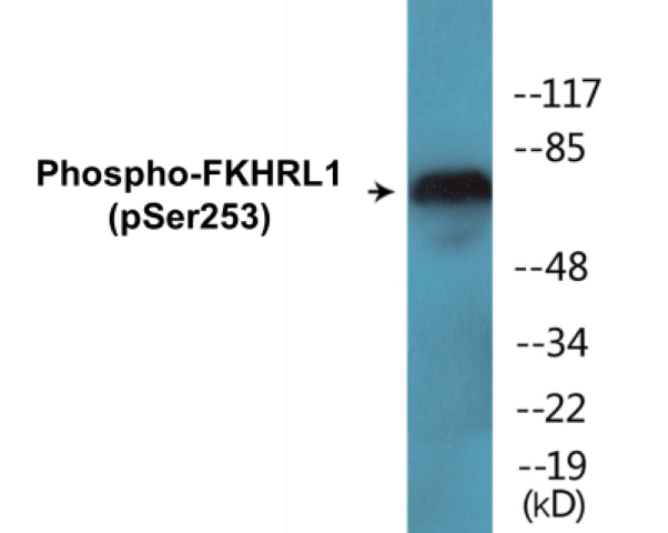 FKHRL1 (phospho Ser253) Cell Based ELISA Kit