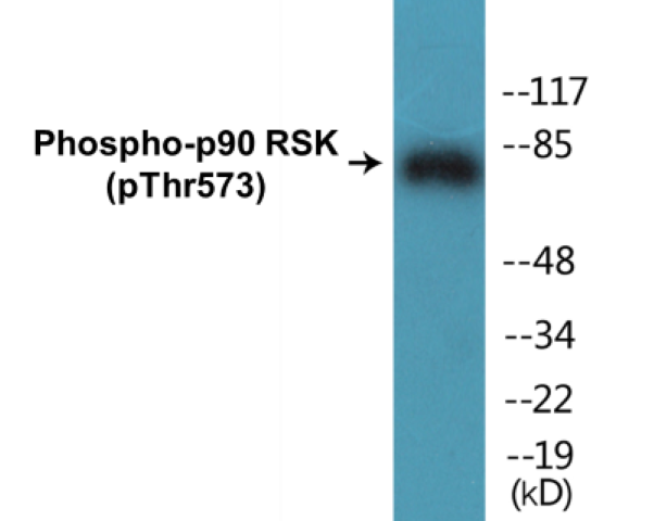 p90RSK (phospho Thr573) Cell Based ELISA Kit