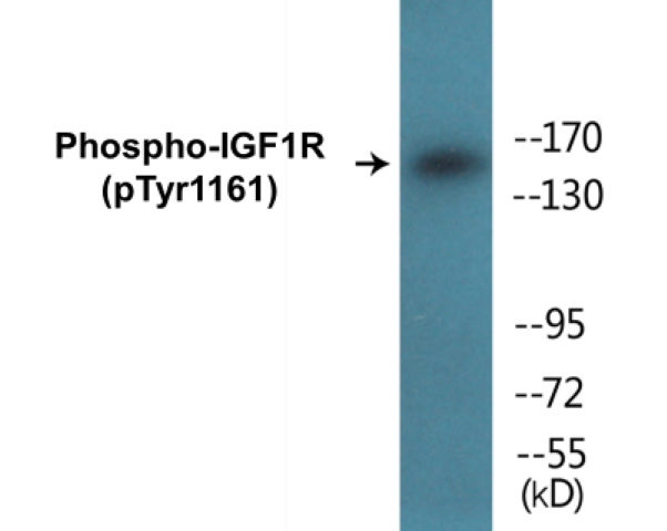 IGF1R (phospho Tyr1161) Cell Based ELISA Kit