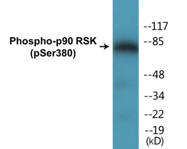 p90RSK (phospho Ser380) Cell Based ELISA Kit