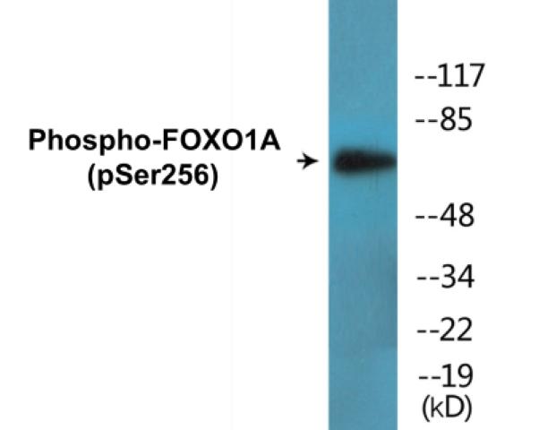 FOXO1A (phospho Ser256) Cell Based ELISA Kit