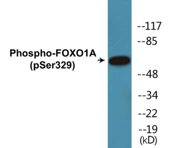FOXO1A (phospho Ser329) Cell Based ELISA Kit