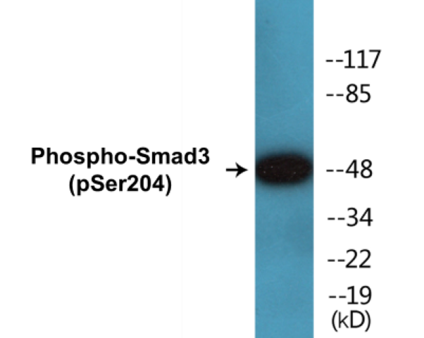 Smad 3 (phospho Ser204) Cell Based ELISA Kit