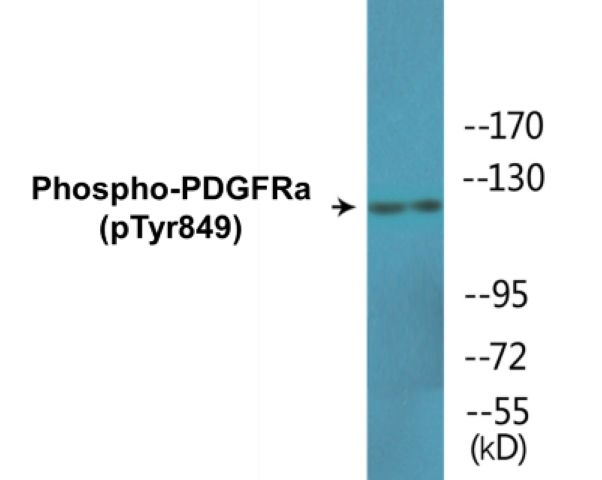 PDGFRa (phospho Tyr849) Cell Based ELISA Kit