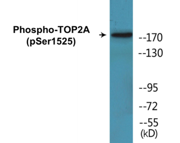 TOP2A (phospho Ser1525) Cell Based ELISA Kit