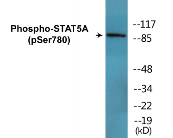 STAT5A (phospho Ser780) Cell Based ELISA Kit