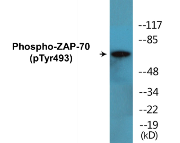 ZAP-70 (phospho Tyr493) Cell Based ELISA Kit
