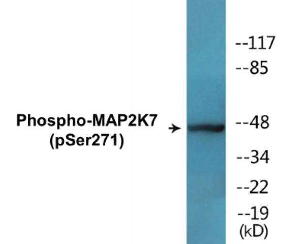 MAP2K7 (phospho Ser271) Cell Based ELISA Kit