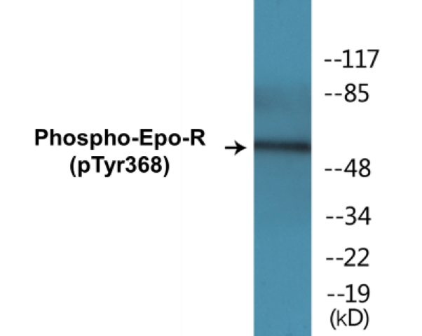 Epo-R (phospho Tyr368) Cell Based ELISA Kit