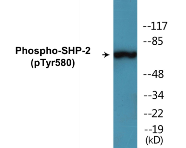 SHP-2 (phospho Tyr580) Cell Based ELISA Kit