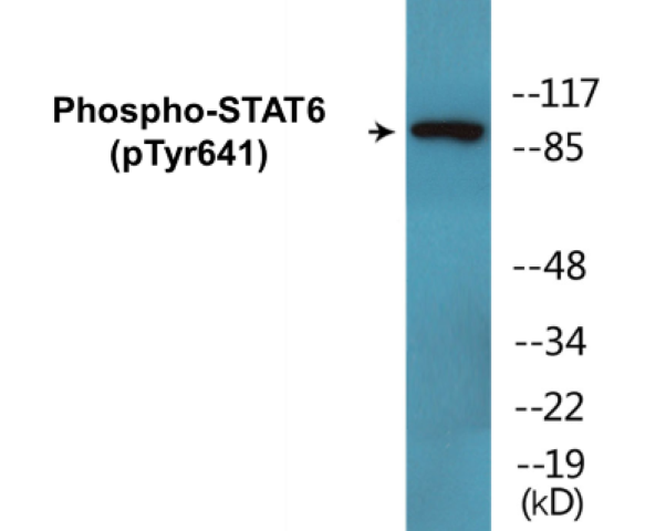 STAT6 (phospho Tyr641) Cell Based ELISA Kit