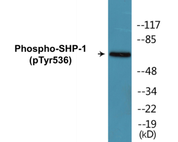 SHP-1 (phospho Tyr536) Cell Based ELISA Kit