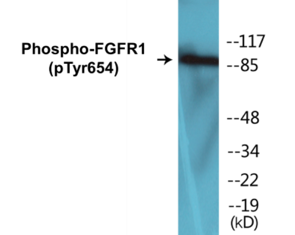 FGFR1 (phospho Tyr654) Cell Based ELISA Kit