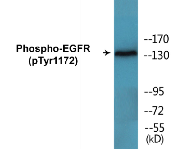 EGFR (phospho Tyr1172) Cell Based ELISA Kit