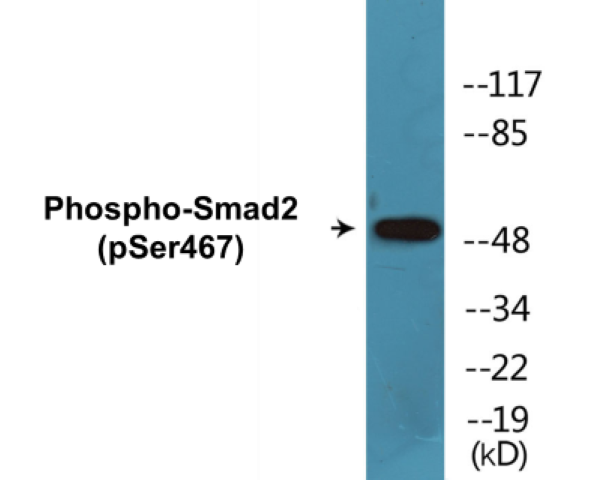 Smad2 (phospho Ser467) Cell Based ELISA Kit