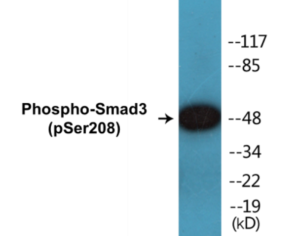 Smad3 (phospho Ser208) Cell Based ELISA Kit