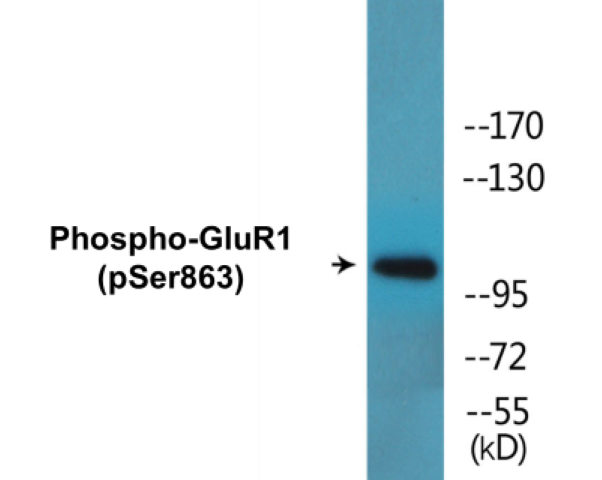 GluR1 (phospho Ser863) Cell Based ELISA Kit
