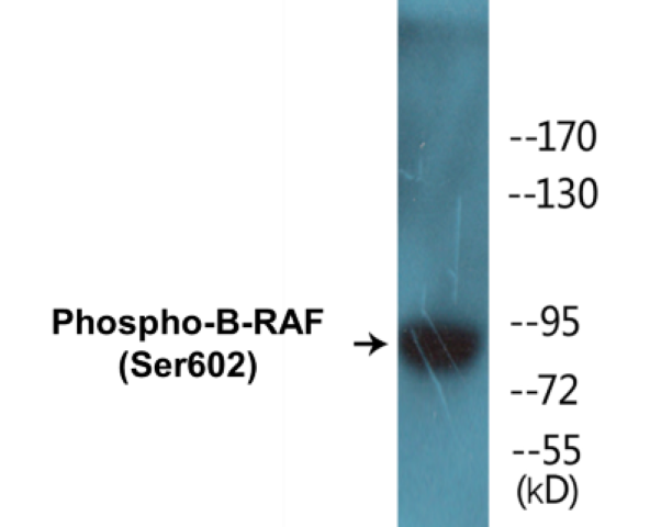 B-RAF (phospho Ser602) Cell Based ELISA Kit