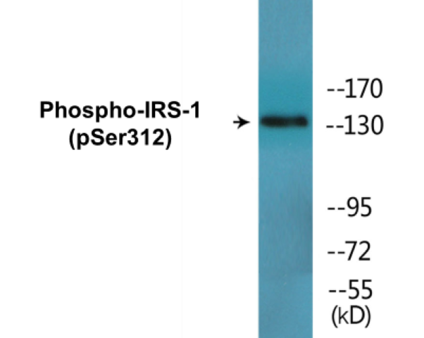 IRS-1 (phospho Ser312) Cell Based ELISA Kit