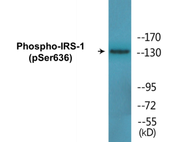 IRS-1 (phospho Ser636) Cell Based ELISA Kit