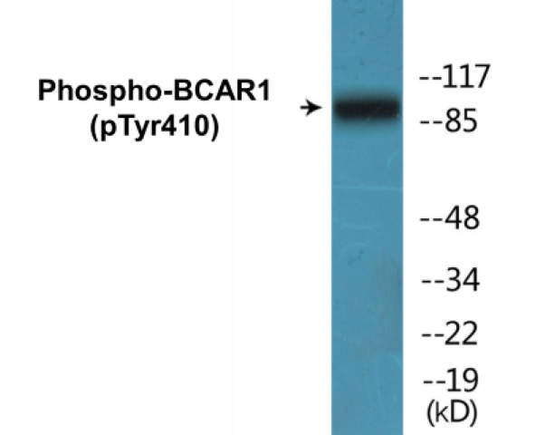 BCAR1 (phospho Tyr410) Cell Based ELISA Kit
