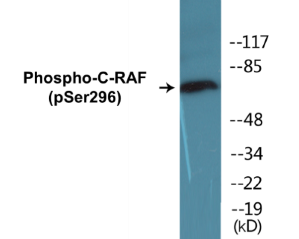 C-RAF (phospho Ser296) Cell Based ELISA Kit