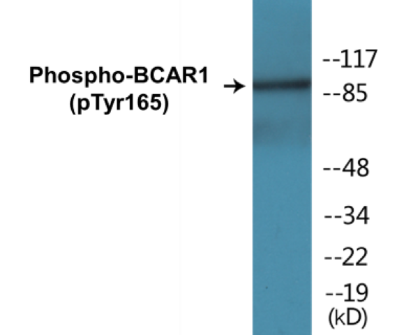 BCAR1 (phospho Tyr165) Cell Based ELISA Kit