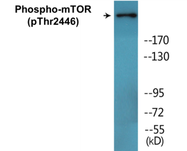 mTOR (phospho Thr2446) Cell Based ELISA Kit