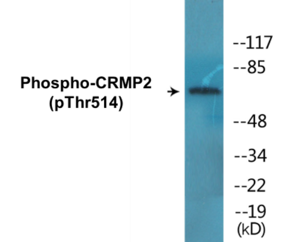CRMP2 (phospho Thr514) Cell Based ELISA Kit