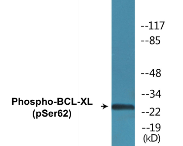 BCL-XL (phospho Ser62) Cell Based ELISA Kit