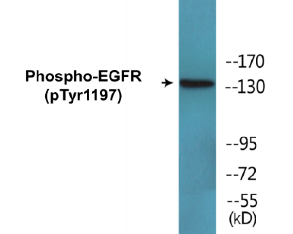 EGFR (phospho Tyr1197) Cell Based ELISA Kit