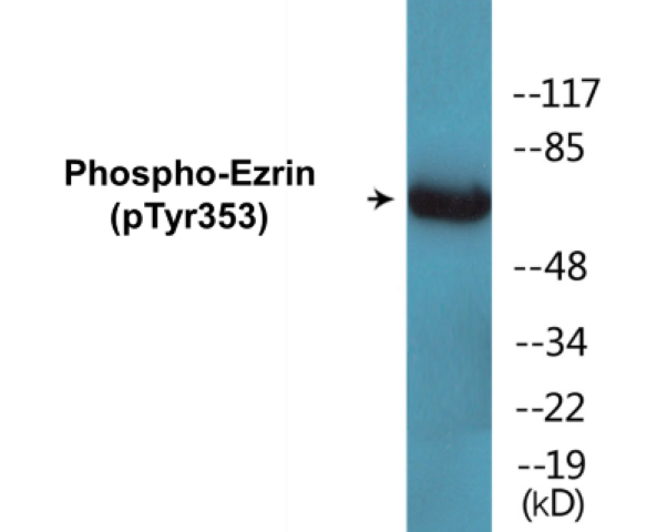 Ezrin (phospho Tyr353) Cell Based ELISA Kit