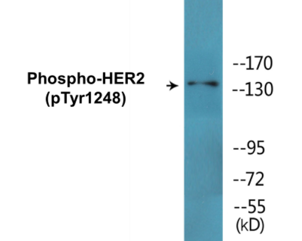 HER2 (phospho Tyr1248) Cell Based ELISA Kit