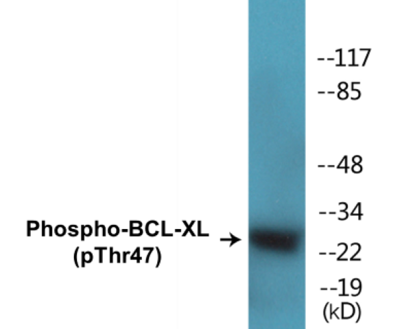 BCL-XL (phospho Thr47) Cell Based ELISA Kit