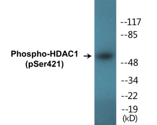 HDAC1 (phospho Ser421) Cell Based ELISA Kit