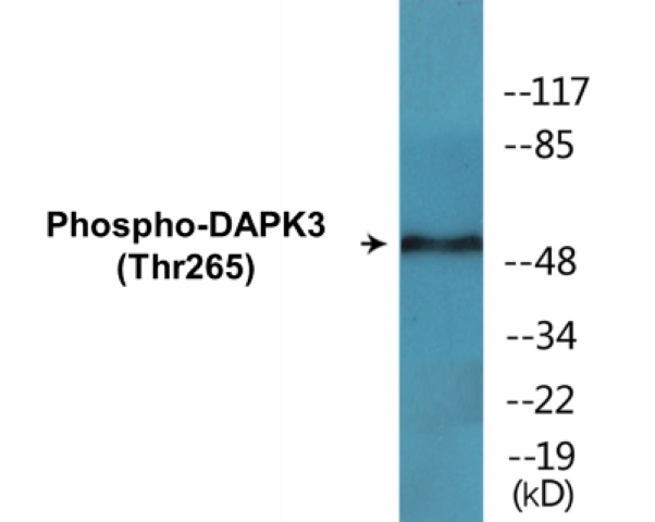 DAPK3 (phospho Thr265) Cell Based ELISA Kit