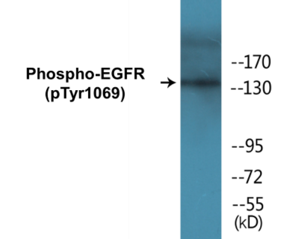 EGFR (phospho Tyr1069) Cell Based ELISA Kit