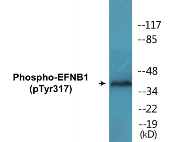 EFNB1 (phospho Tyr317) Cell Based ELISA Kit